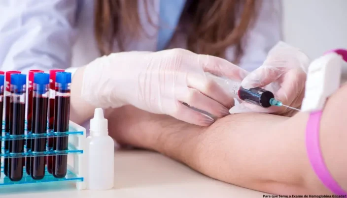 Para que Serve o Exame de Hemoglobina Glicada? 1 Entenda para que serve o exame de hemoglobina glicada e como ele pode auxiliar no controle do diabetes.