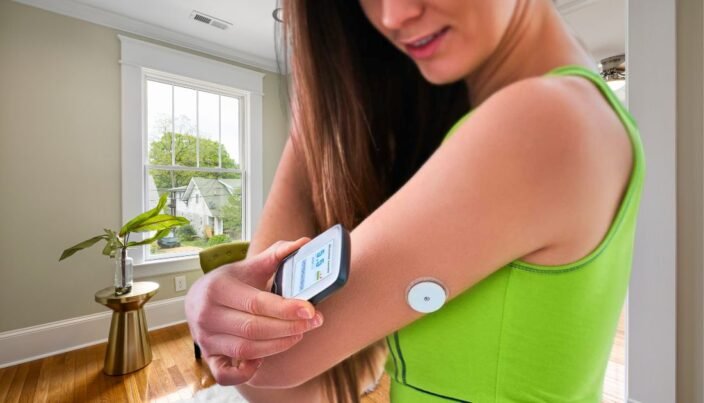 Medidor de Glicose sem Furo no Dedo: Tecnologia e Marcas 1 Pessoa usando medidor de glicose sem furo no dedo no braço, conectado a um aplicativo no celular para monitoramento contínuo.